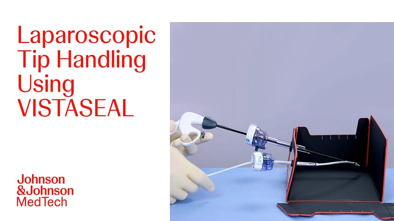 Laparoscopic Tip Handling Procedure Using VISTASEAL Fibrin Sealant | J&J MedTech