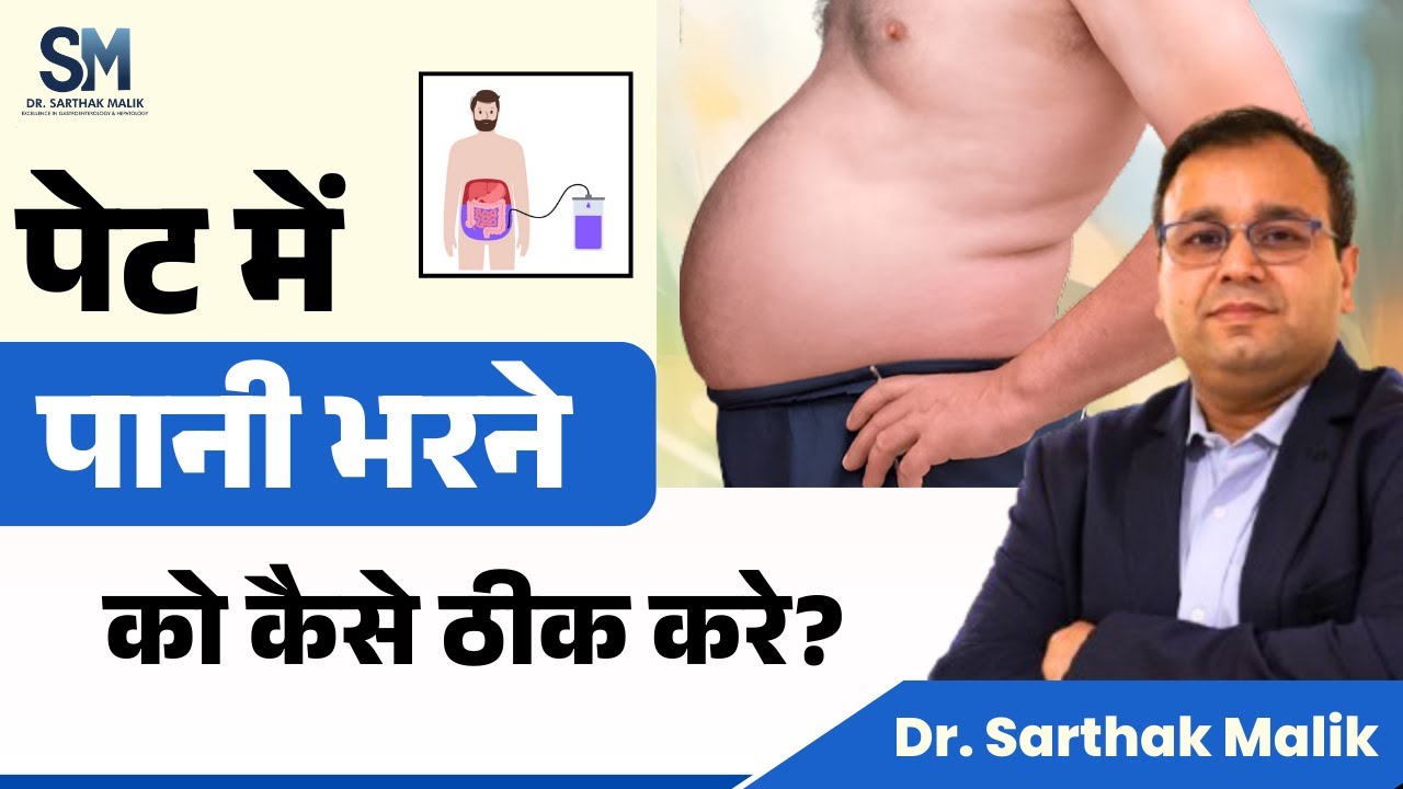 पेट में पानी भरने का इलाज I Ascites Treatment I Dr. Sarthak Malik
