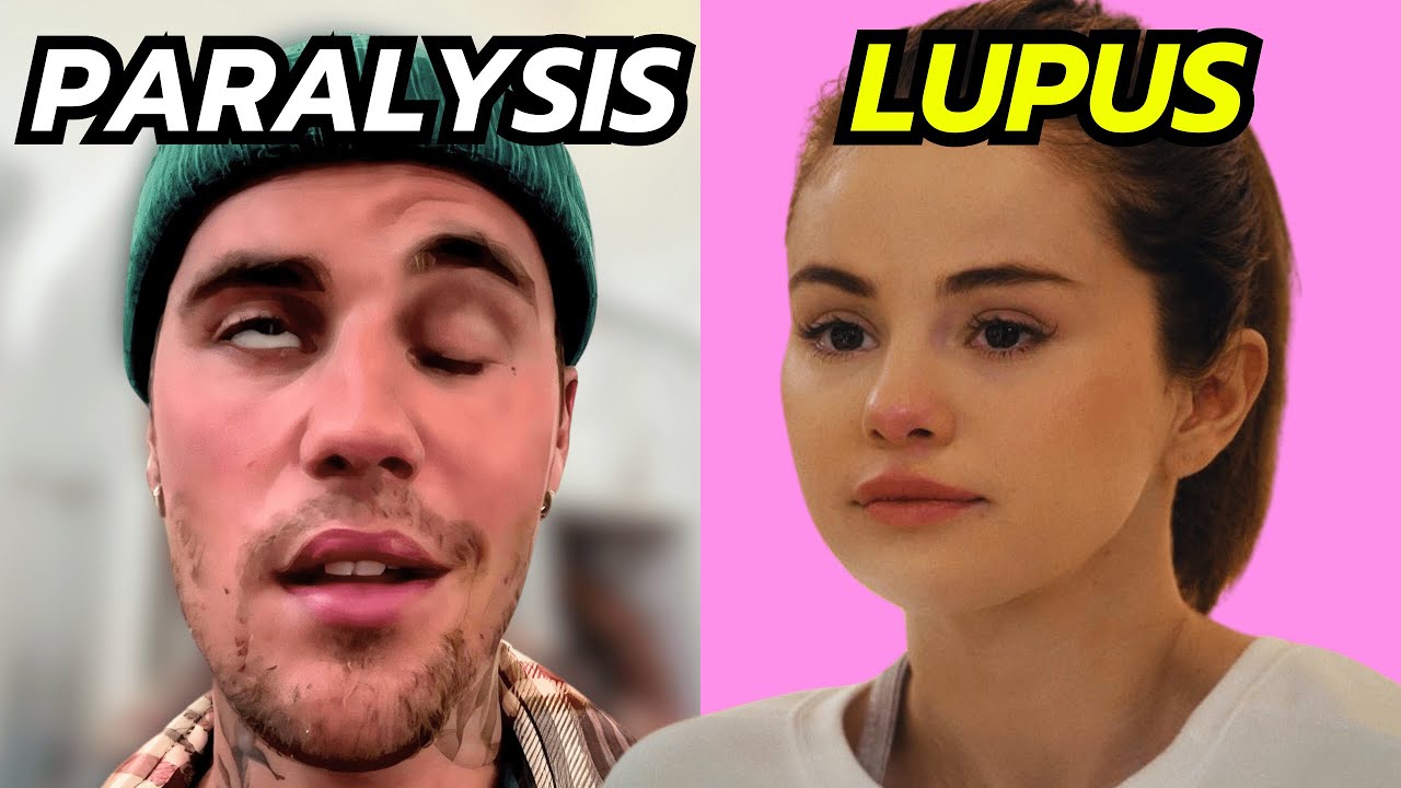 Shocking Celebrity Health Struggles: Chronic Illnesses Revealed