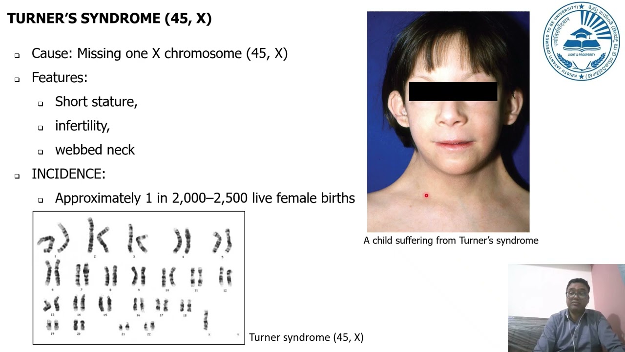 ANEUPLOIDY AND UNIPARENTAL DISOMY IN HUMANS