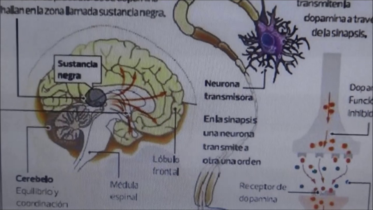 BIOELECTRICIDAD EN LAS NEURONAS-  PARKINSON