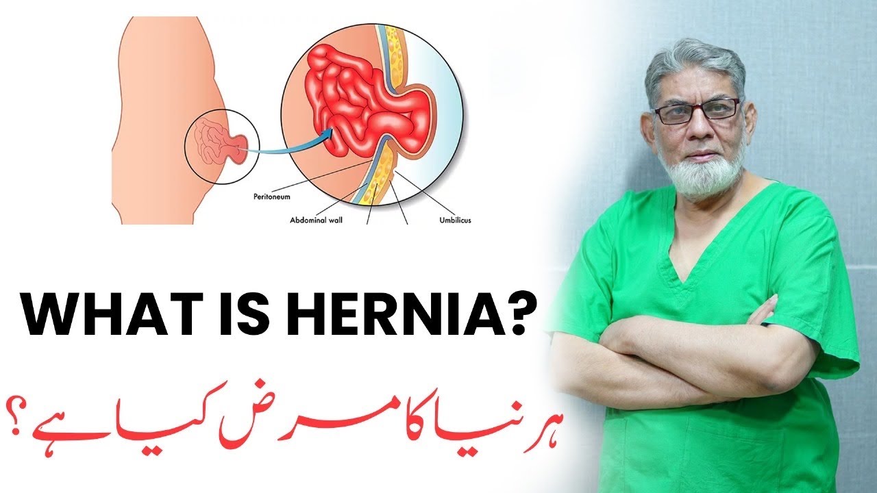 What is Hernia? | Explained by Senior Surgeon Professor Dr. Javed Iqbal