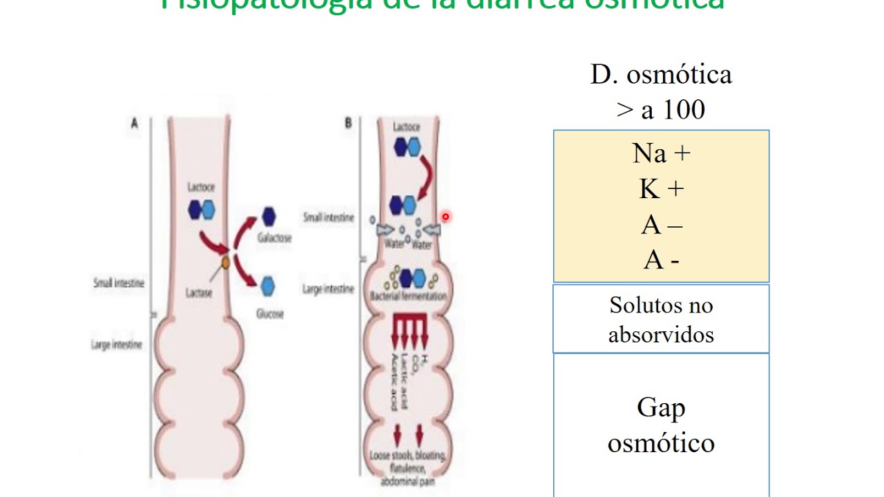 Fisiopatología Diarrea Dra  Mayor