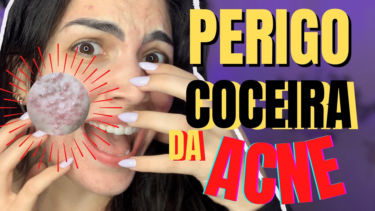 ESPINHAS COÇANDO É SINAL DE PERIGO!! TUDO EXPLICADO
