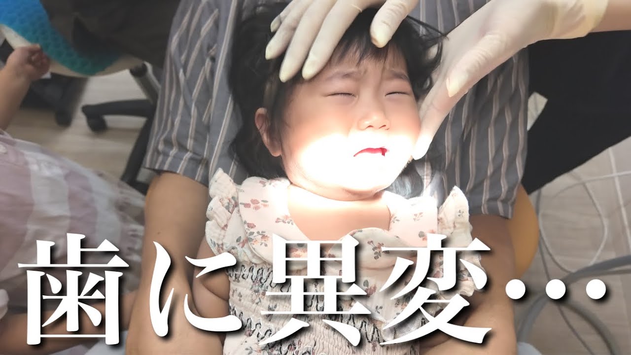 【1歳児】歯がおかしい…初めての歯科健診でパパママが知らない事実が発覚しました。