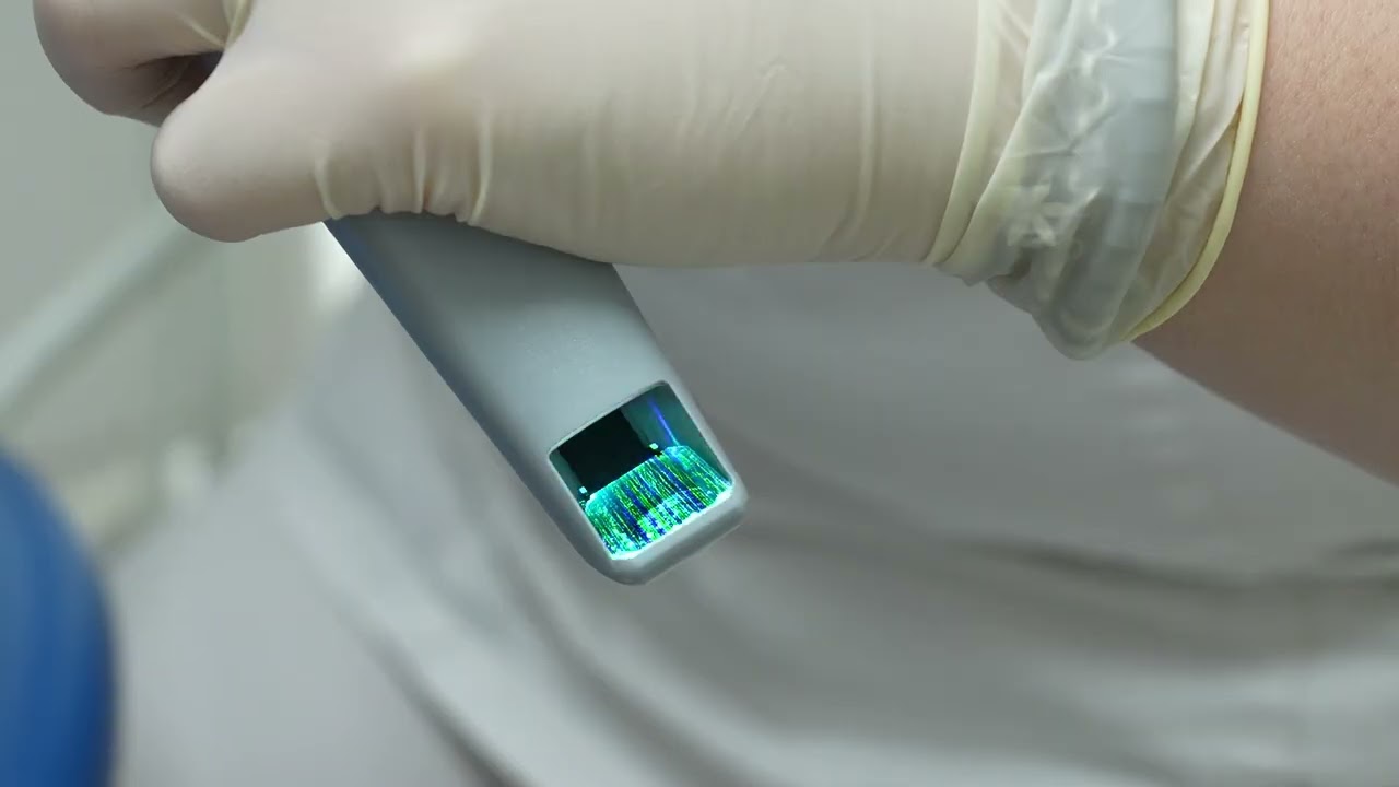 VIDEO Dimostrativo Scansione dentale 3D