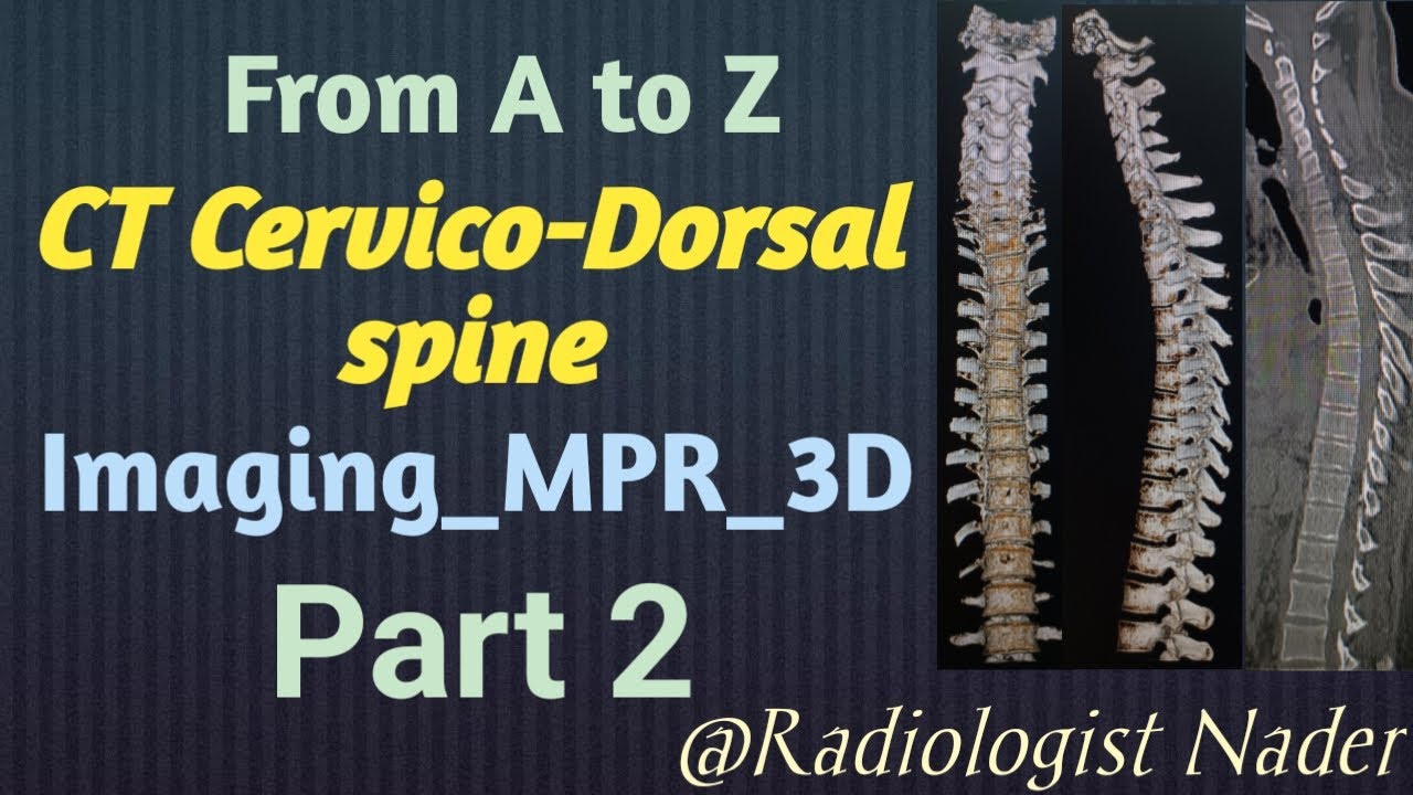 CT scan of the cervical-thoracic vertebrae|Part 2|Multi-plane reconstruction