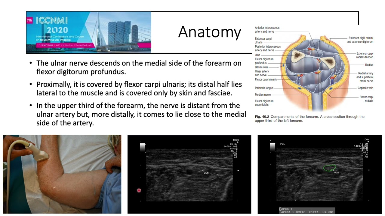 ICCNMI 2021 - Anatomy and scan demo of the ulnar nerve