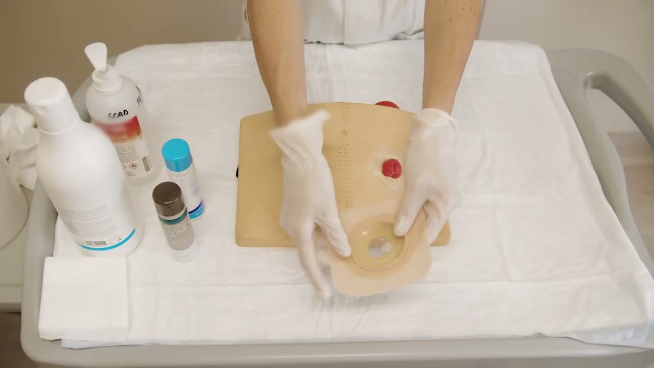 Guida allo stomacare - Colo/Ileostomia, sistema bipezzo placca modellabile flottante