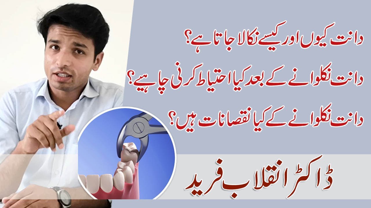 Why & How to Extract a Tooth? What are Post Operative Precautions? Benefits and Disadvantages