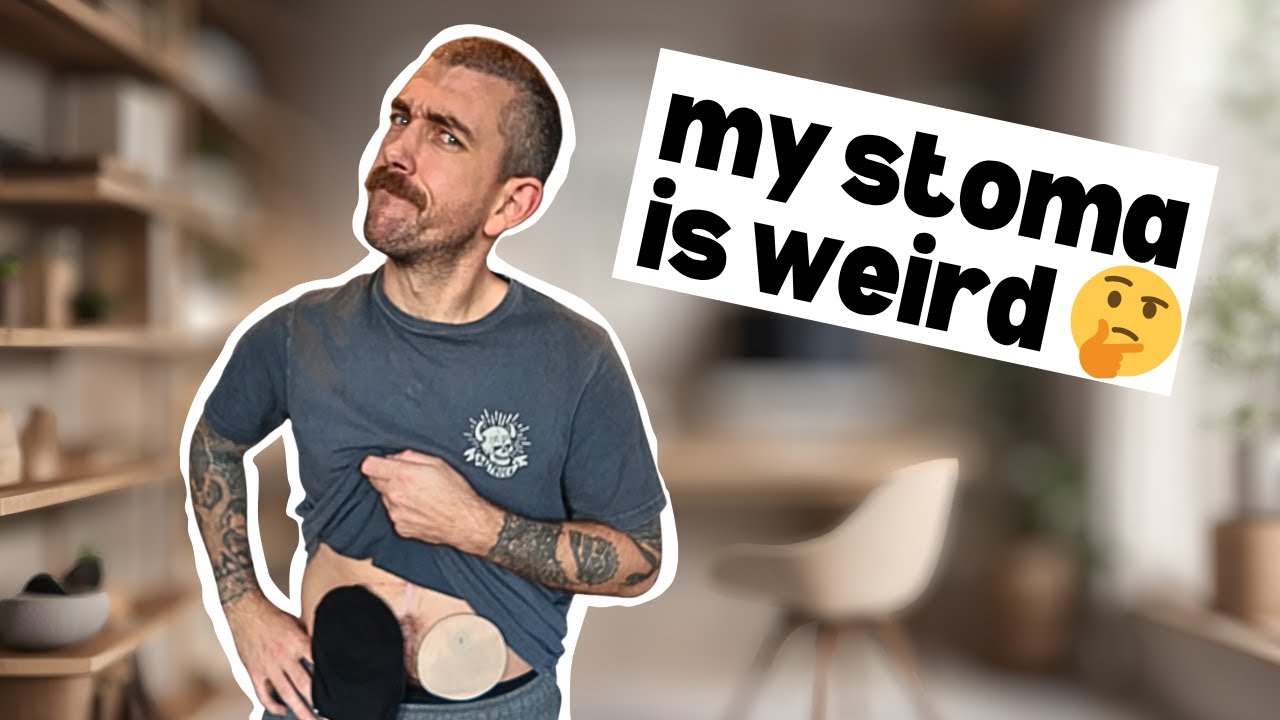 7 Weird Things About Having a Stoma (That No One Talks About)