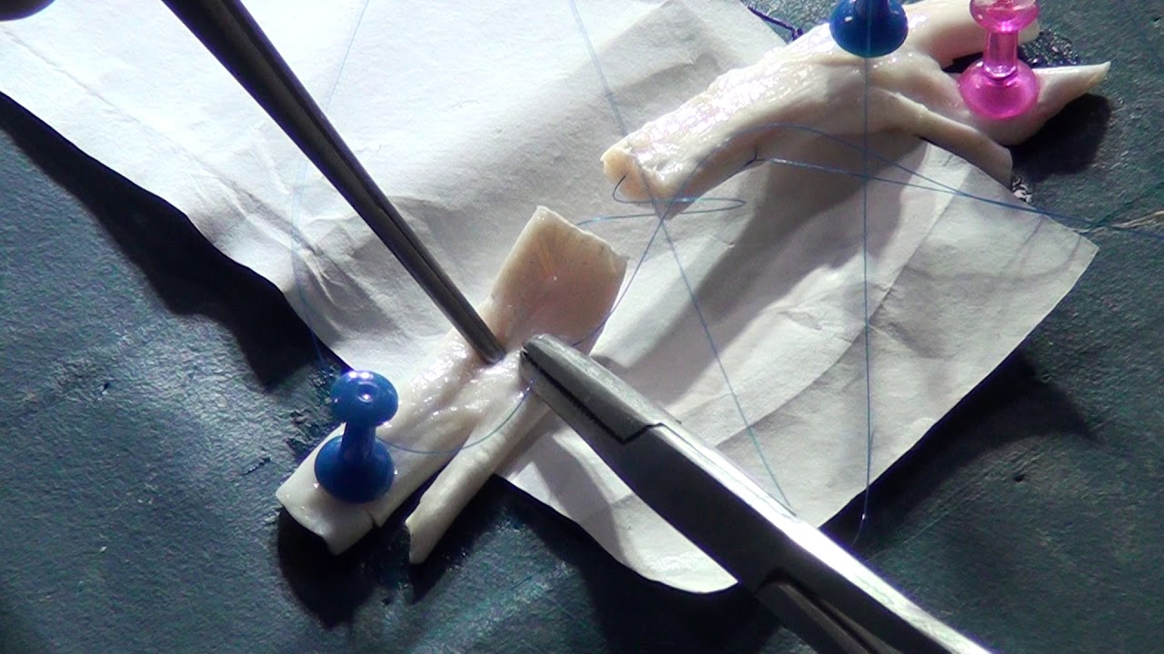 Basic Surgical Skills by Dr. Chintamani part 17