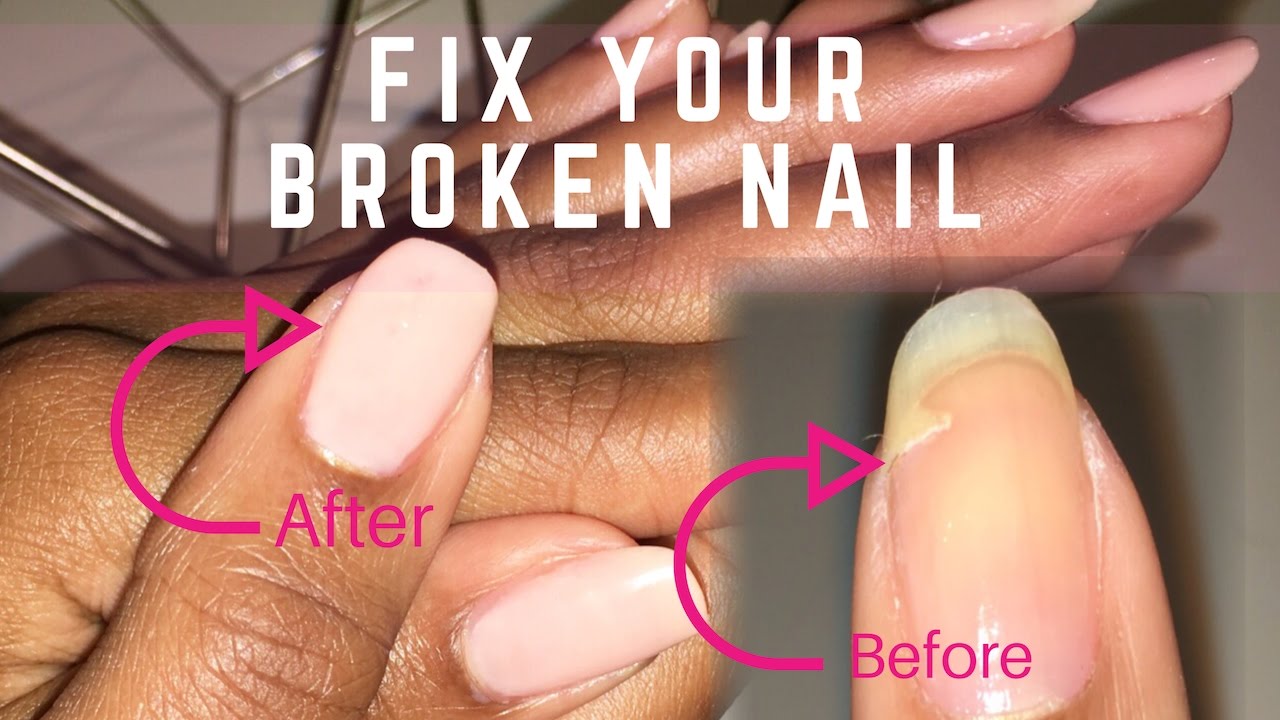 How to Fix a Broken Nail With A Tea Bag! | natural nail repair