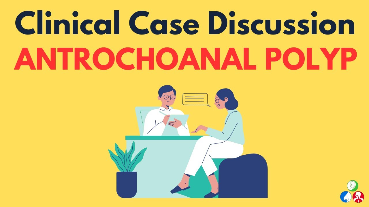 Antrochoanal Polyp - Clinical Case Presentation | Nasal Polyp | Long case Nose
