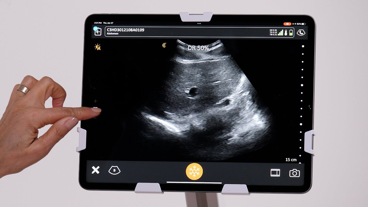 Adjusting Dynamic Range