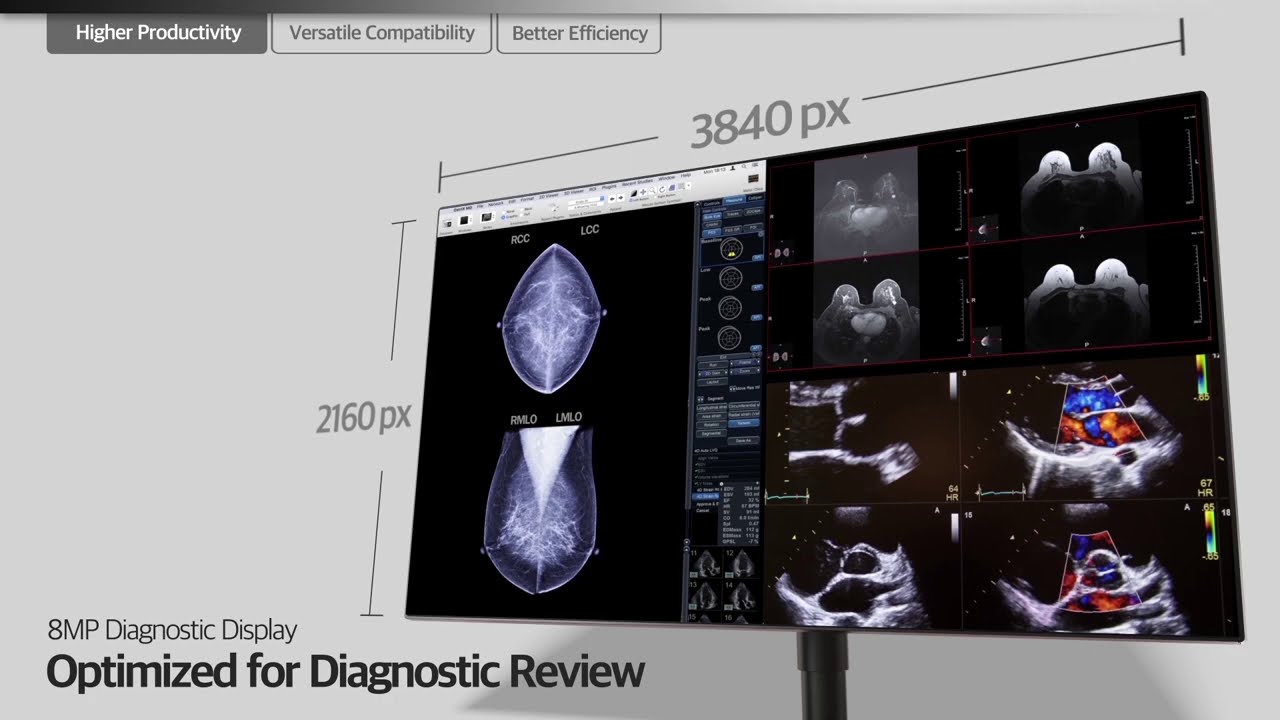 Get Accurate Image from Any Angle with LG Diagnostic Monitor 32HL512D,21HK512D