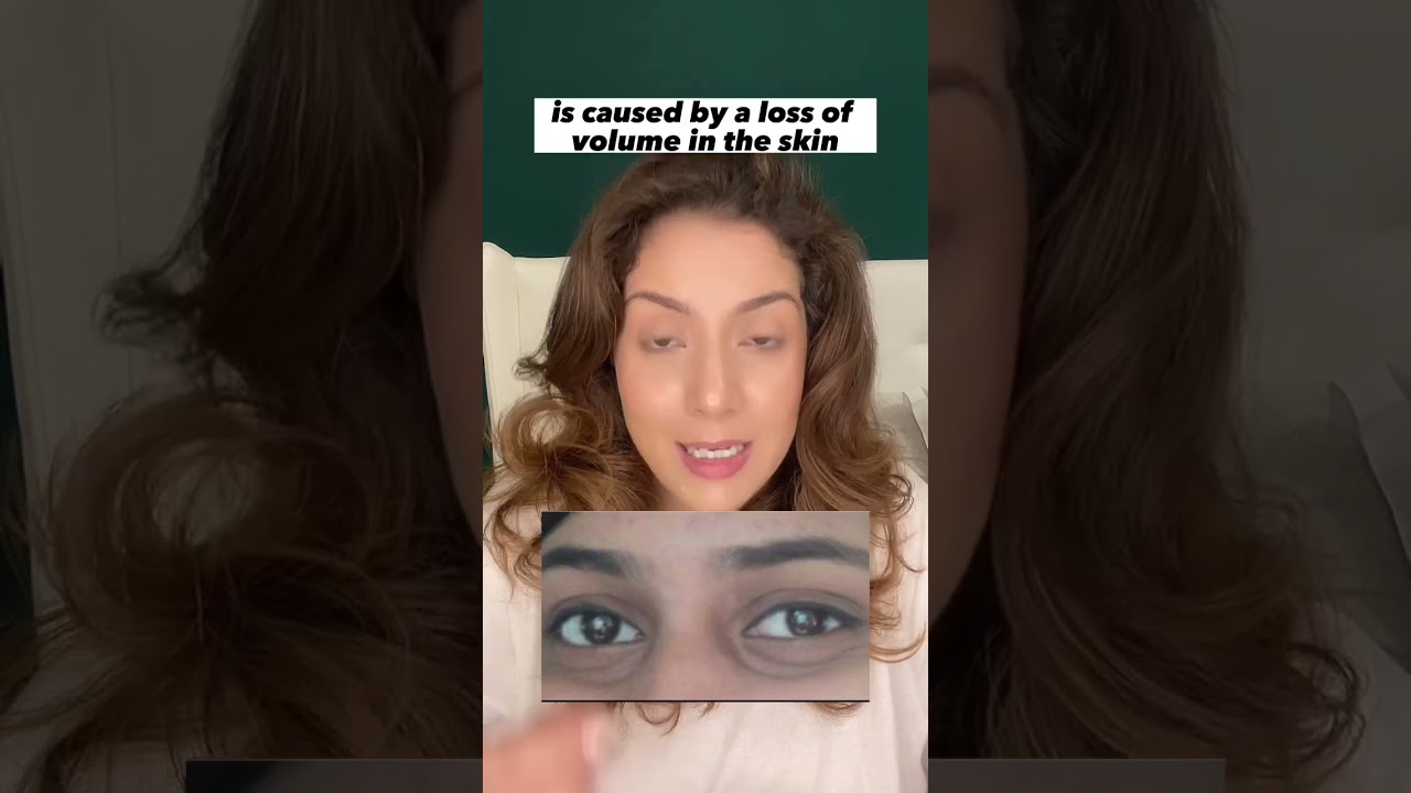 Listen if you have under eye hollowness #shortsvideo #skincare #skincaretips