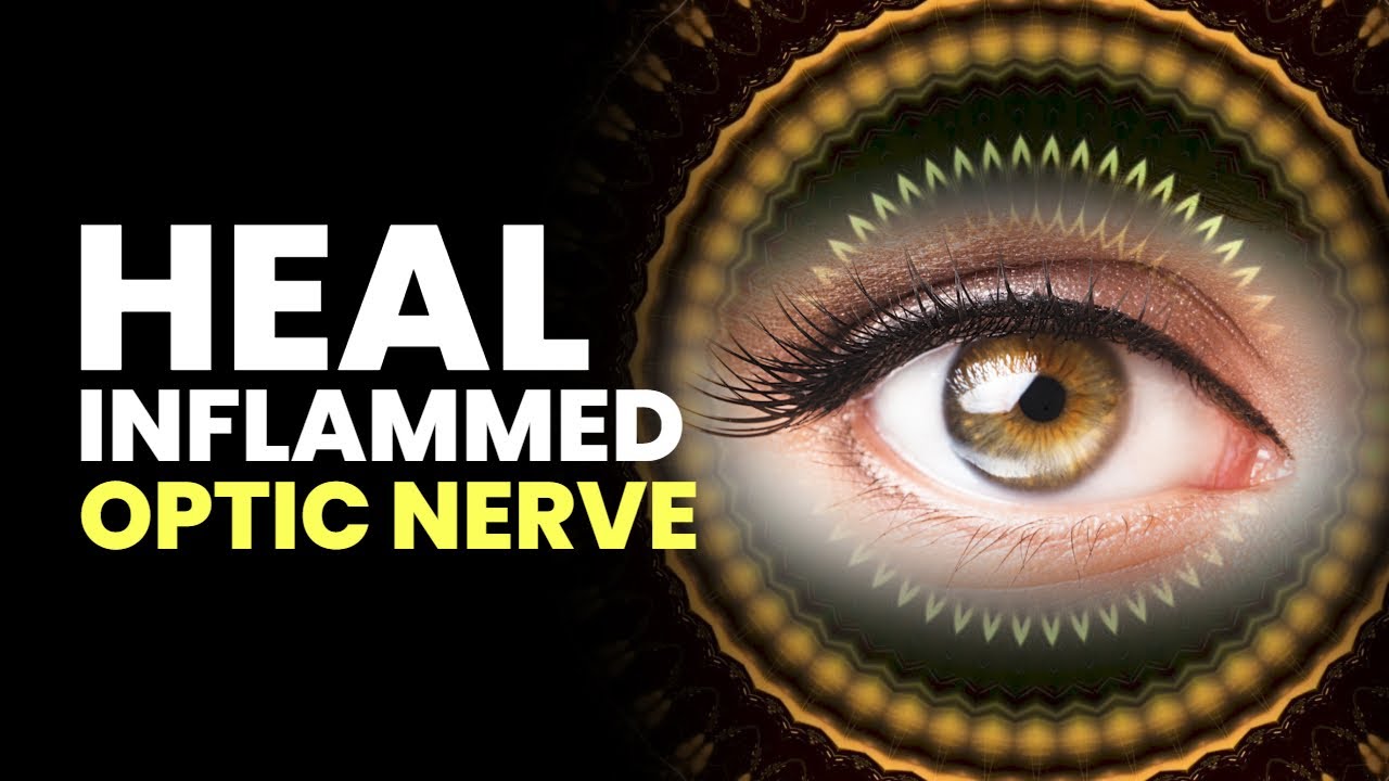 Heal Inflamed Optic Nerve | Get Rid From Pain In Eye Blurry Vision & Weak Eyesight | Binaural Beats