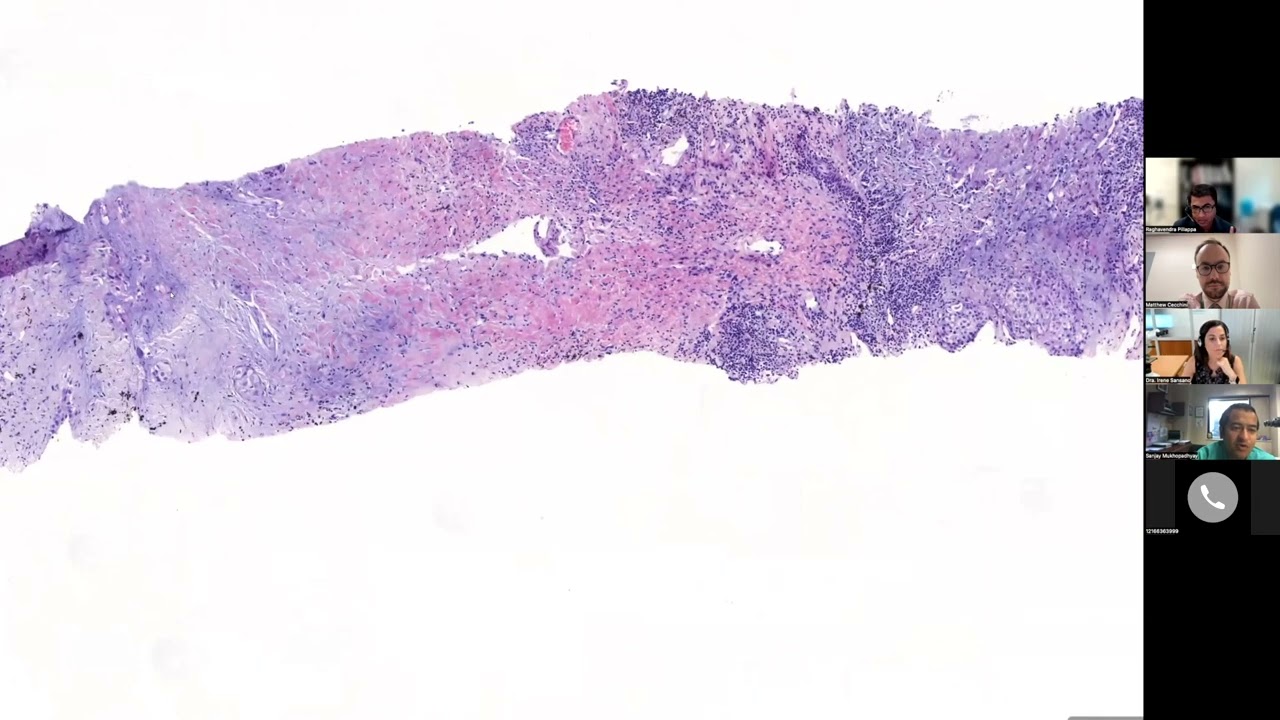 Fresh Air, Season 2, Episode 1: Thoracic Pathologists Discuss Pulmonary Pathology Cases