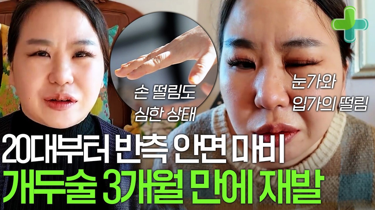 '20대부터 반측 안면 마비가 왔어요...' 안면 마비 고치려고 개두술 했는데 3개월만에 재발