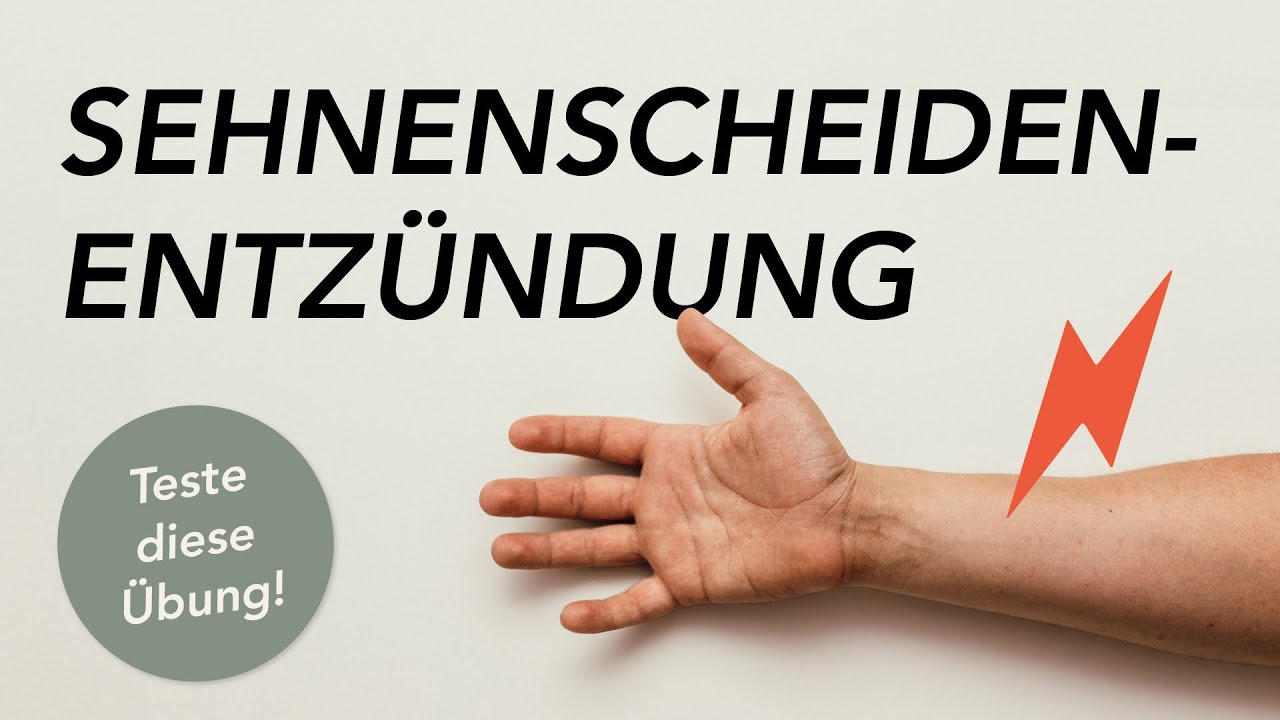 Sehnenscheidenentzündung | Mache diese Übung!