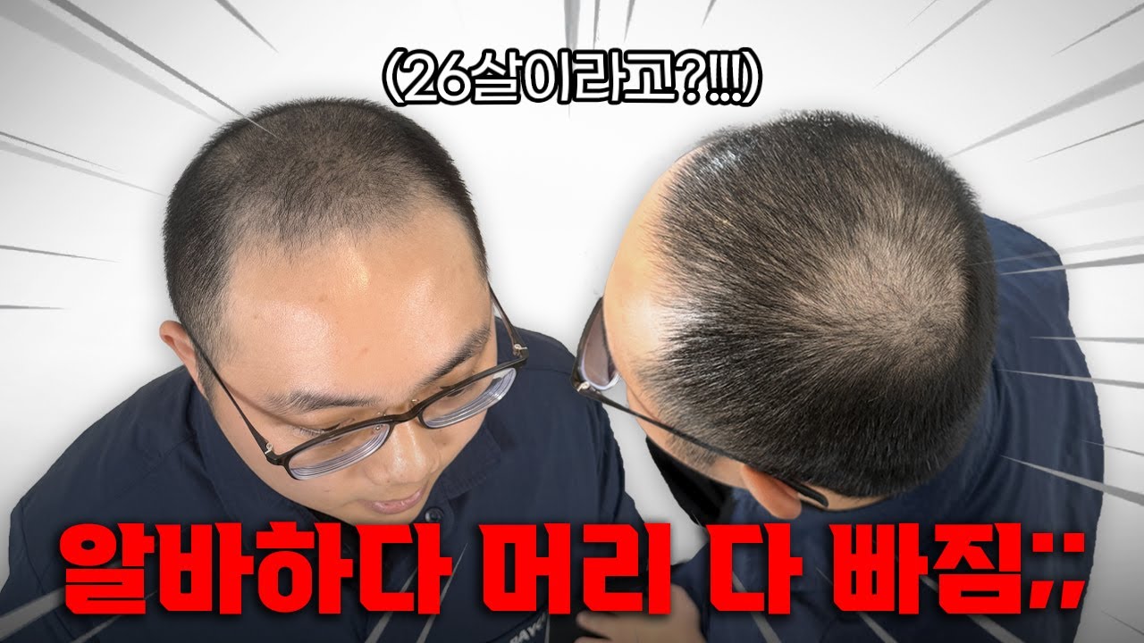 알바만 했을 뿐인데 머리가 다 빠졌다고요?😨😨