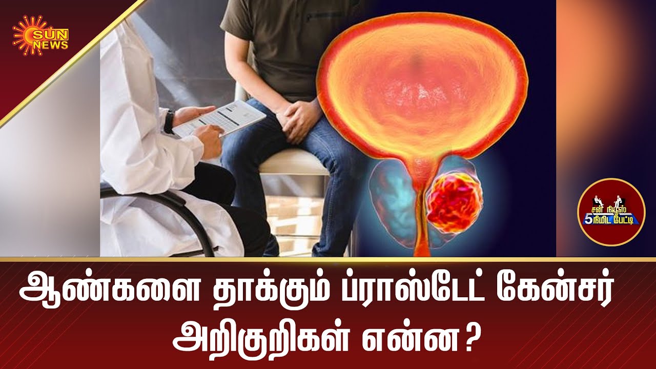ஆண்களை தாக்கும் ப்ராஸ்டேட் கேன்சர் அறிகுறிகள் என்ன? | 5MinInterview | Tamil News | Sun News