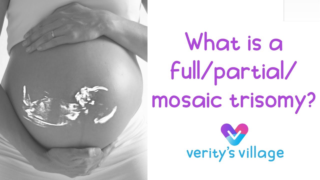 Full, Mosaic, & Partial Trisomy