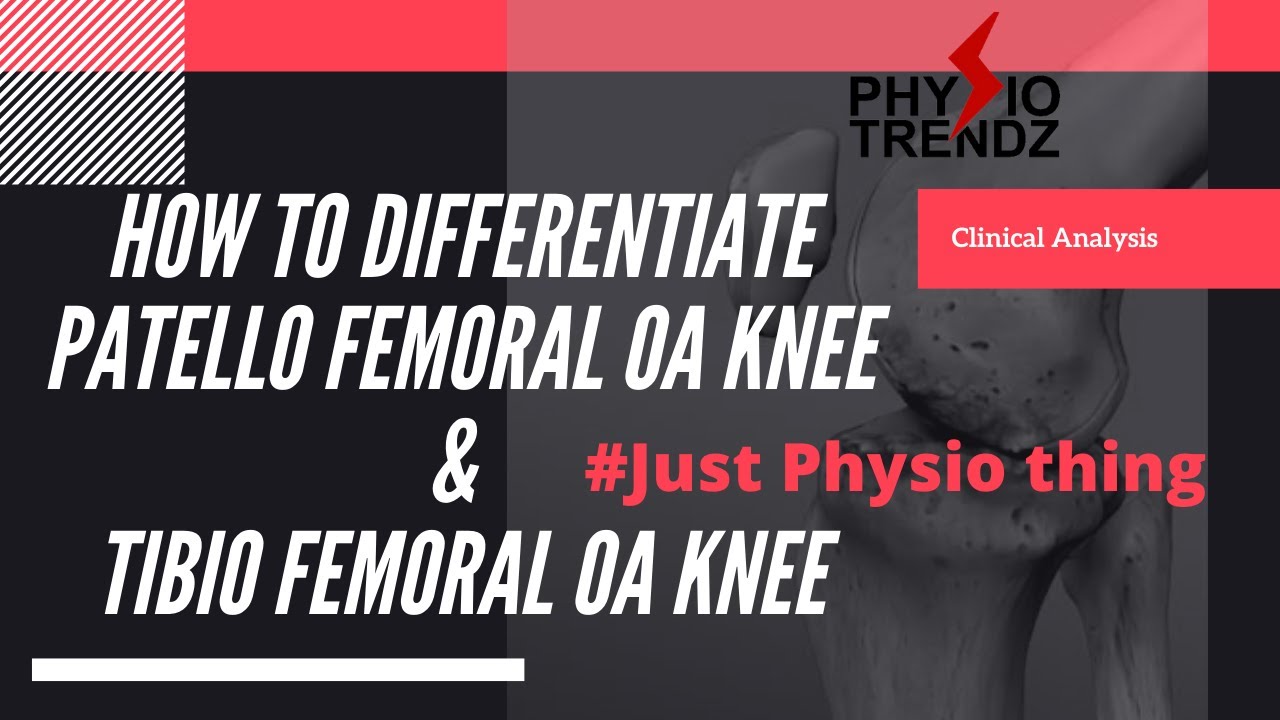 Fast Knee Osteoarthritis Diagnosis Tips