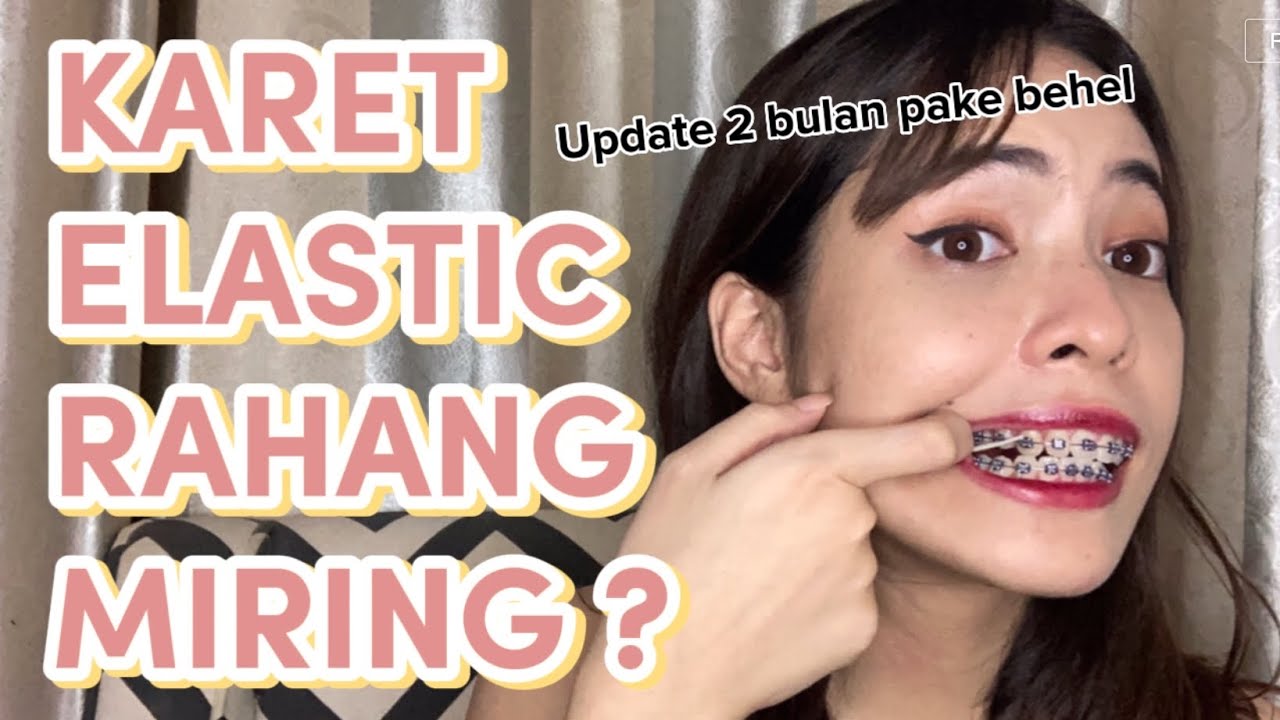 KARET ELASTIC UNTUK RAHANG MIRING?? - update 2 bulan pake behel | Braces Journey