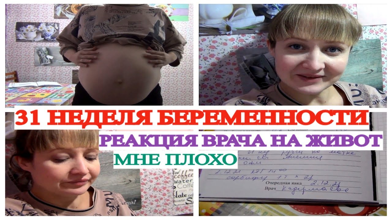 31 НЕДЕЛЯ БЕРЕМЕННОСТИ🤰 ВРАЧ В ШОКЕ ОТ МОЕГО ЖИВОТА😲 АНЕМИЯ🤕 ДАВЛЕНИЕ