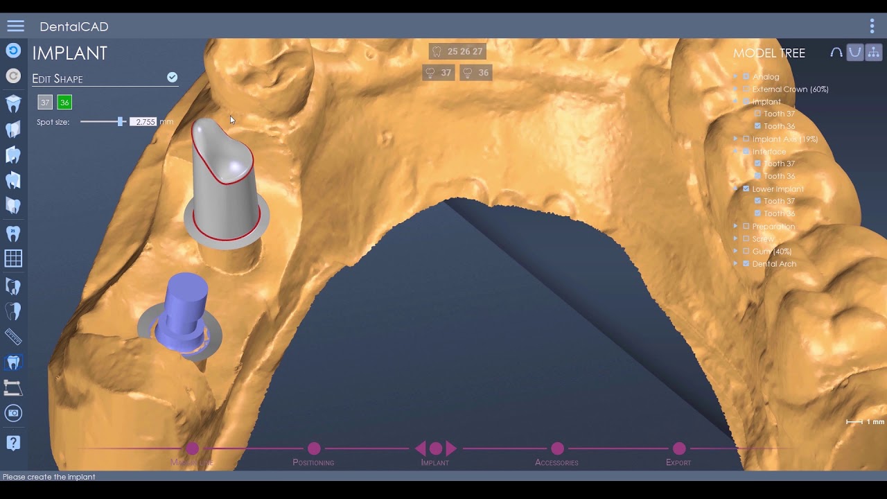 DentalCad 2020 - Novedades pt. 2