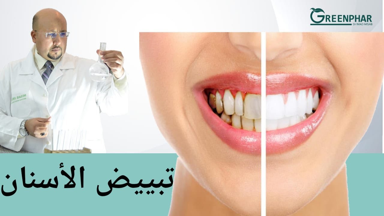 وصفة طبيعية لتبييض الأسنان والتخلص من الرائحة الكريهة | الدكتور عماد ميزاب Dr Imad Misab