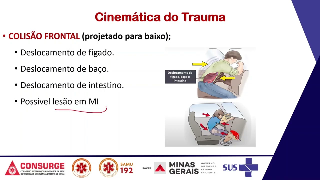 Cinemática do Trauma