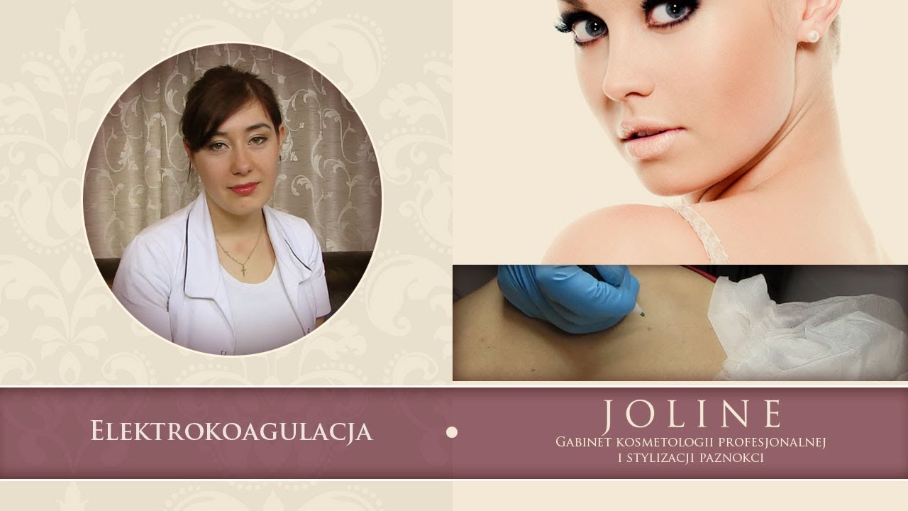 Elektrokoagulacja - Gabinet Kosmetyczny Joline