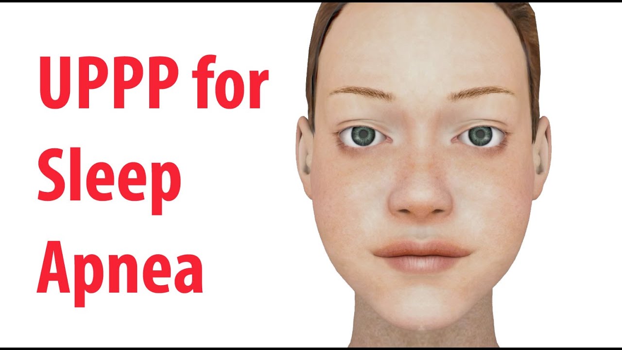 Uvulopalatopharyngoplasty (UPPP) для апноэ сна у взрослых
