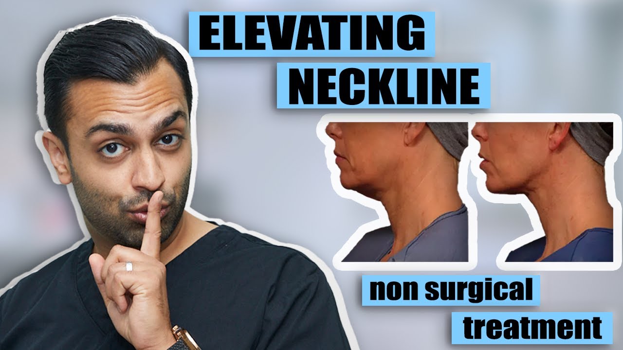 How to Elevate Your Neckline Non-surgical | Dr. Somji Explains Advantages of Necklift Treatment