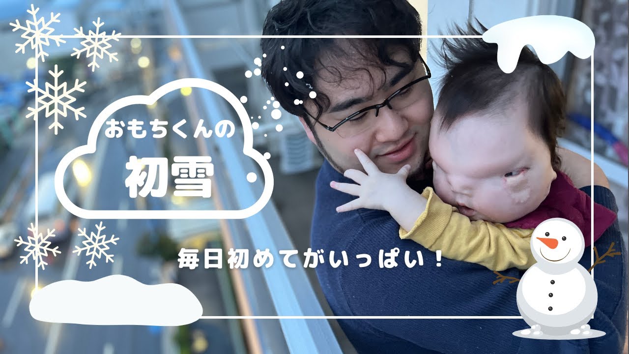 【小耳症/難聴】【1歳0ヶ月】ろう学校に行ってきました！