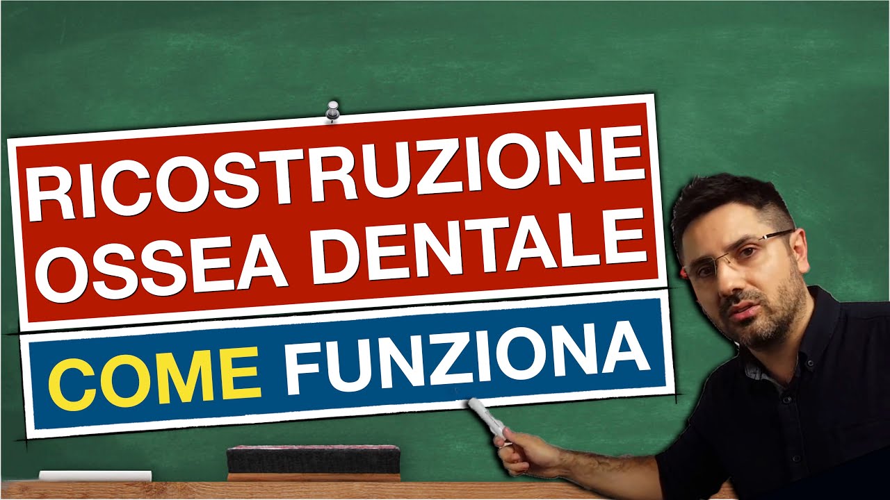 2-5 | Ricostruzione ossea dentale | Rialzo seno mascellare e split crest