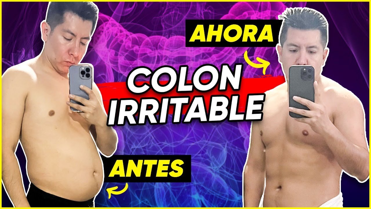 ¡ASÍ ME CURÉ del SÍNDROME de INTESTINO IRRITABLE! 😮 | Mr Doctor