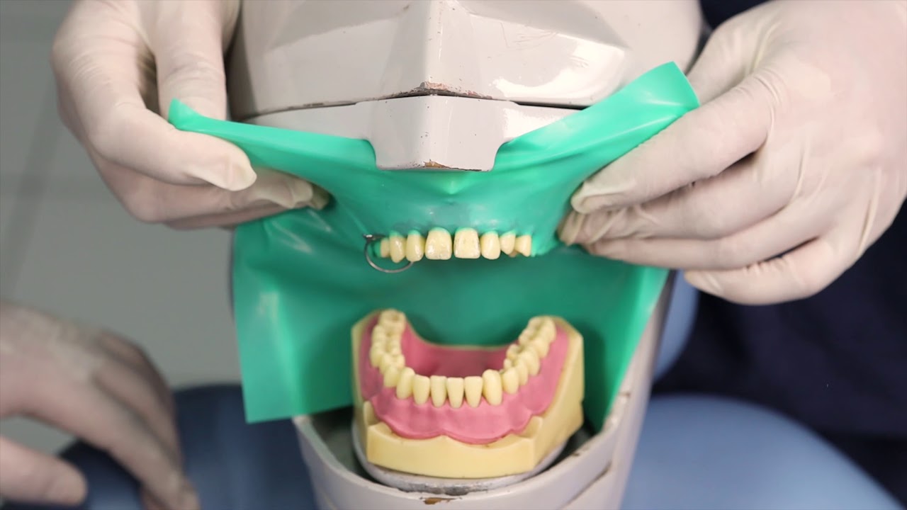 Pemasangan Rubber Dam dengan Teknik Rubber First (2)