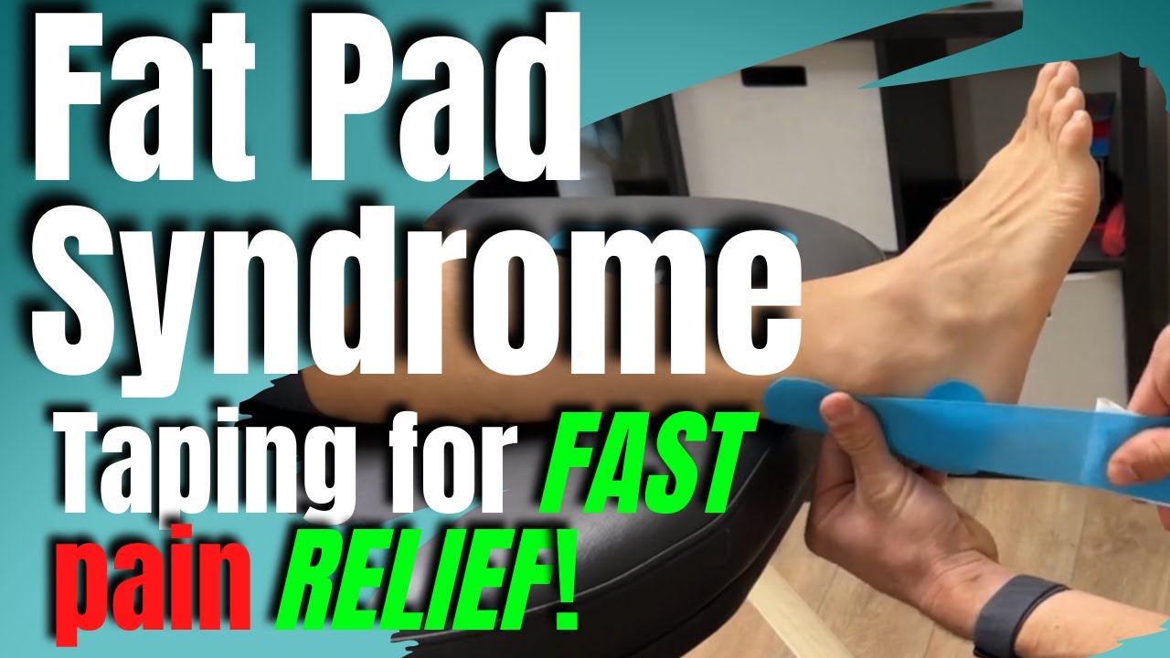 Fat Pad Syndrome Taping | San Diego Sports Therapy