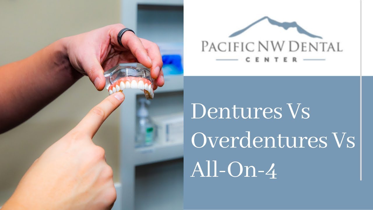 Dentures vs Overdentures vs All-On-X