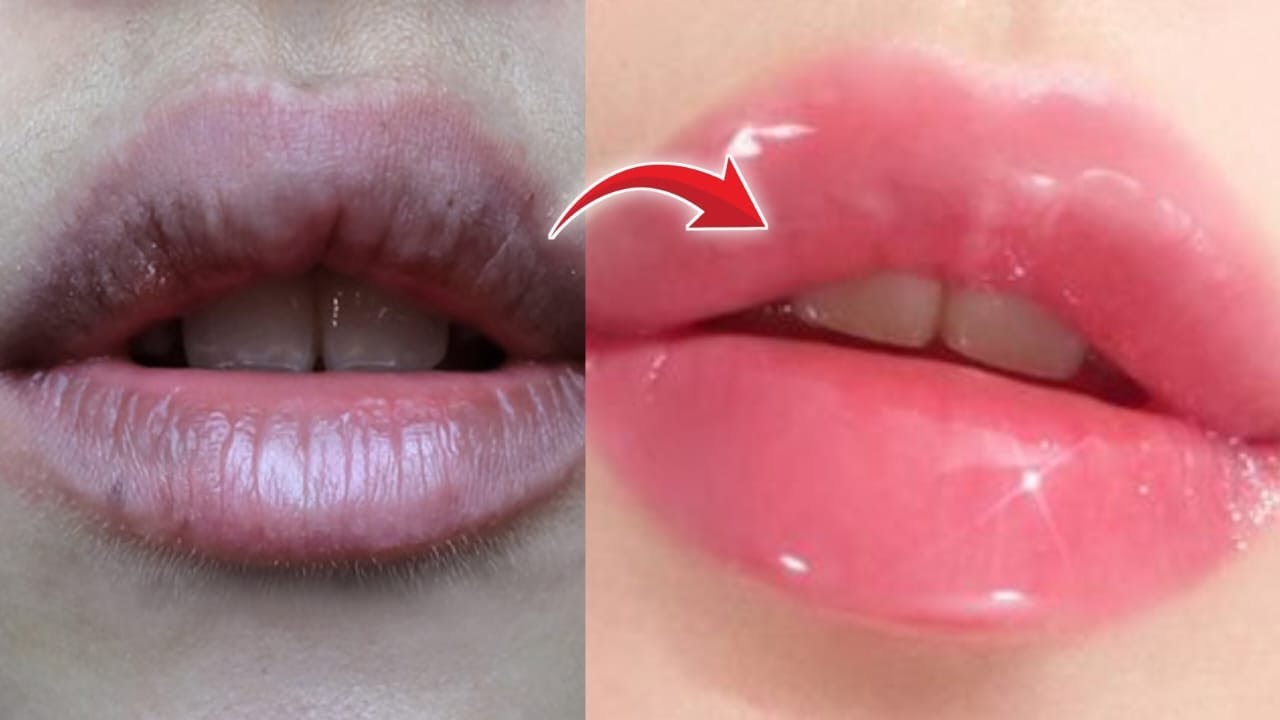 Tan removal home remedy | Lip moisturizing balm