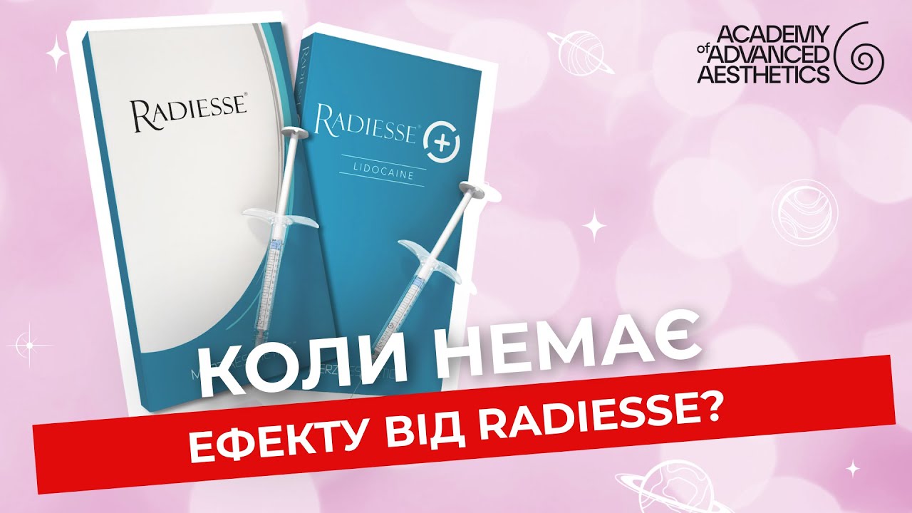Коли немає ефекту від Radiesse?
