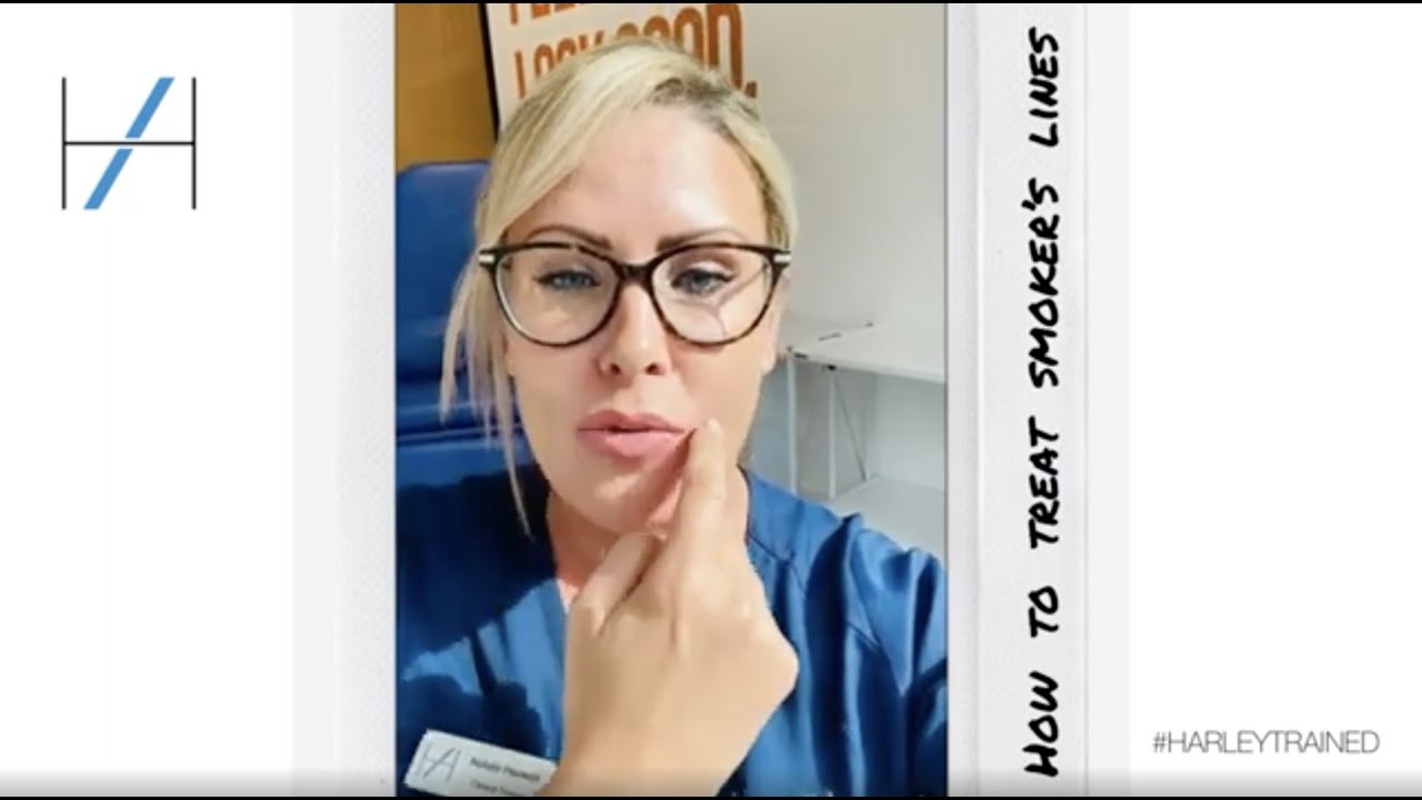 How to Treat Smoker's Lines  - Advice from a Medical Aesthetics Expert #HarleyTrained Cosmetic Nurse
