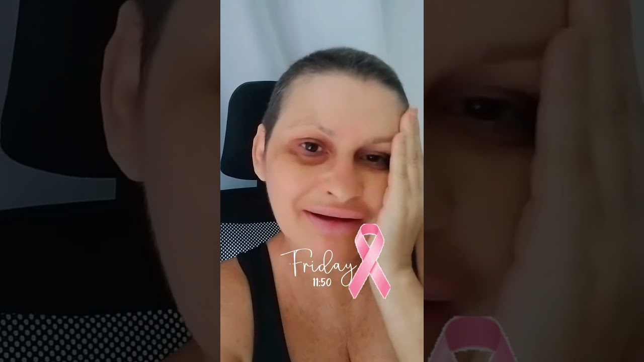 30 de janeiro 2026 como foi o dia ontem  #cancerdemama #quimioterapia #diaadia  #vivendocomproposito