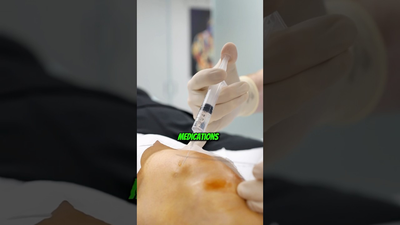 Is there an alternative to knee surgery? #kneepain #painmanagement #kneesurgeryrecovery