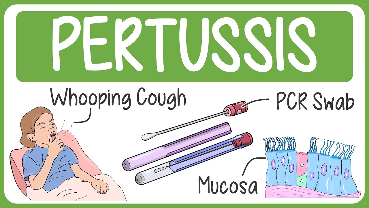 Pertussis Visually Explained