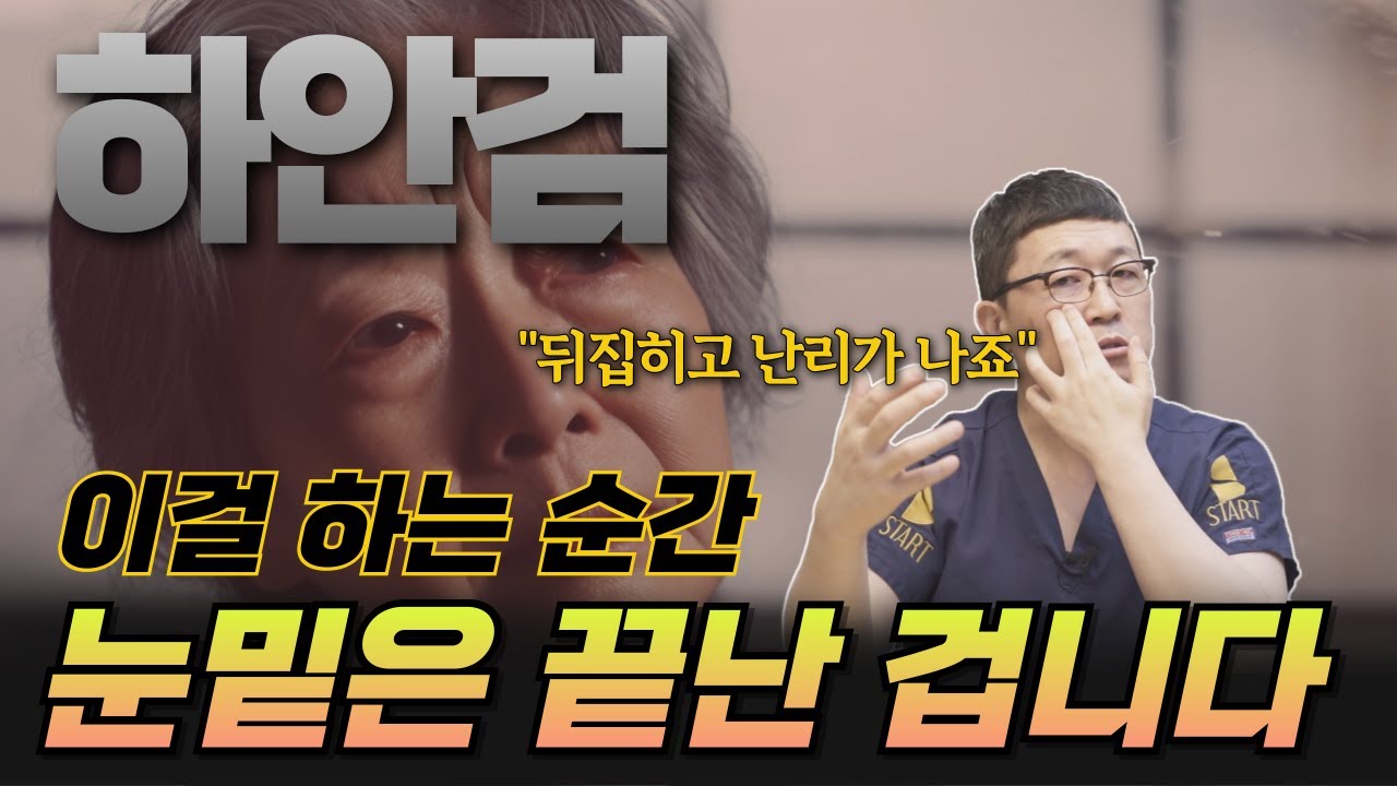 정말 이건 아닙니다. 하안검 하기 전에 꼭 확인하세요.